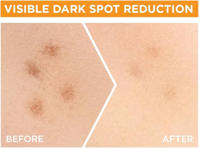 GARNIER VITAMIN C FACE SERUM 30ML